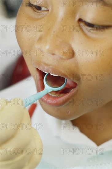 Close up of dentist's hand holding dental mirror in boy's mouth