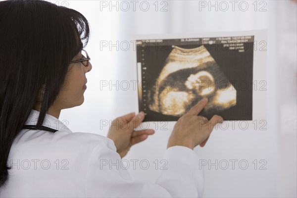 Female doctor looking at sonogram