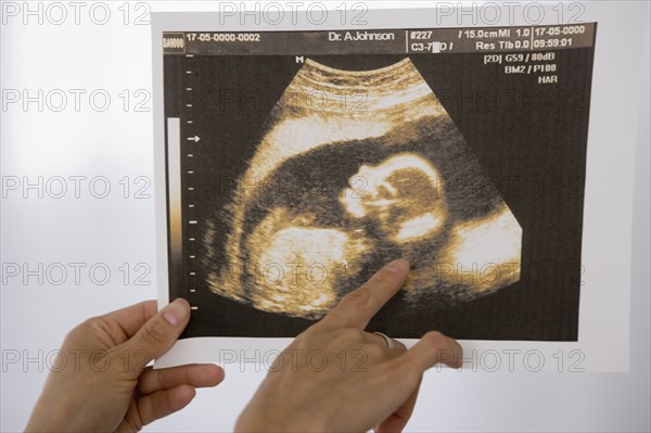 Woman pointing at sonogram