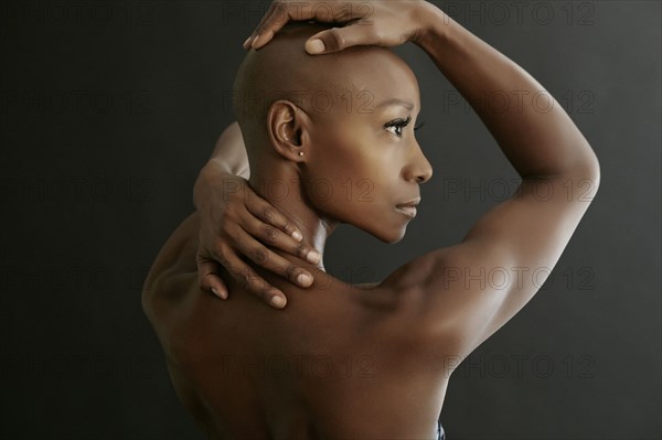 African American woman holding her bald head