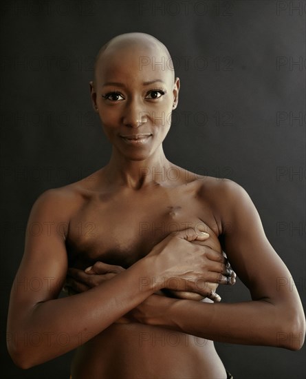 Nude African American cancer survivor covering her breasts