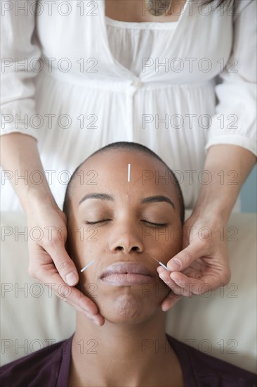 Black woman receiving acupuncture treatments