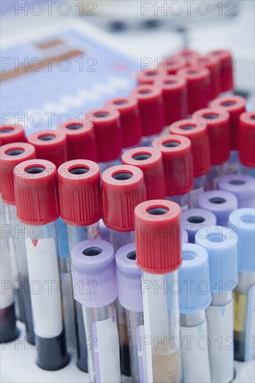 Close up of blood samples in test tube rack in laboratory