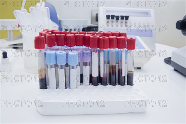 Close up of blood samples in test tube rack in laboratory