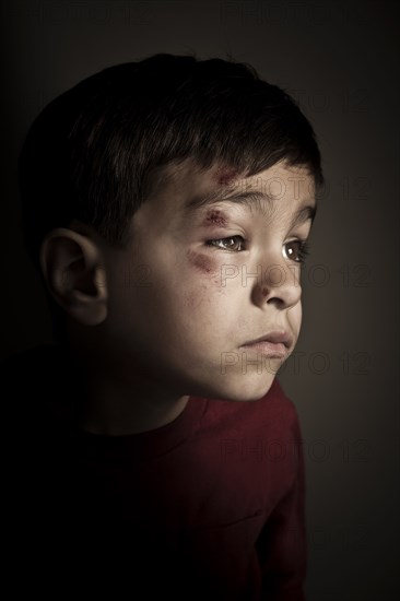 Mixed race boy with scrapes on his face