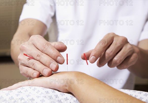 Acupuncturist working on patient