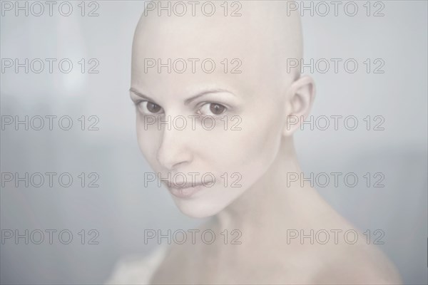 Caucasian woman with bald head