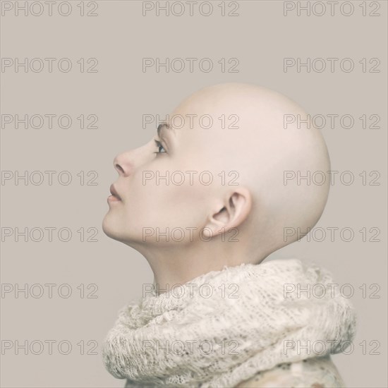 Caucasian woman with bald head