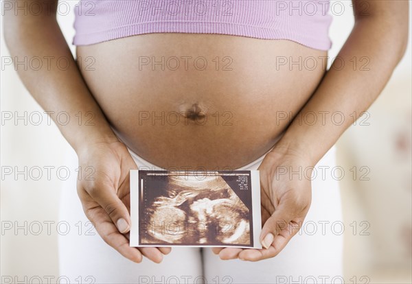 Pregnant African American woman holding ultrasound printout