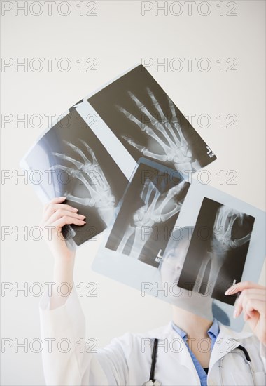 Korean doctor looking at x-rays of hand bones