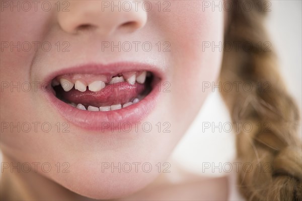 Caucasian girl wiggling loose tooth