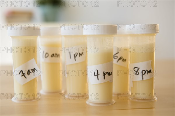 Vials of breast milk with time