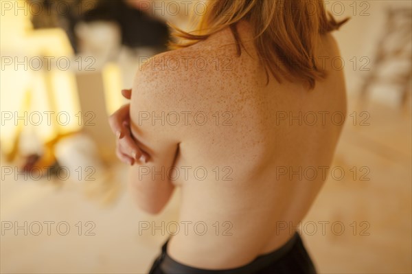 Freckled skin of young woman