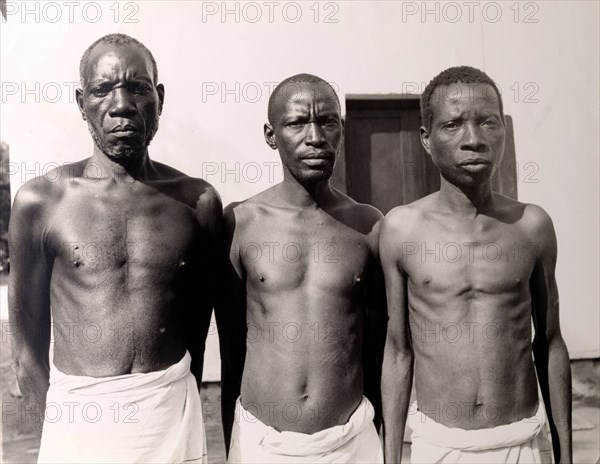 Three men in a line. Official publicity shot for the Tanganyikan government. Three men pose bare-chested for the camera, possibly for a public demonstration from health professionals. Tanganyika Territory (Tanzania), circa 1950. Tanzania, Eastern Africa, Africa.