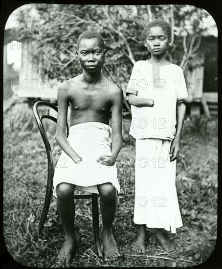 Two mutilated children. Portrait of two mutilated children: victims of atrocities committed under King Leopold II's terror regime. Yoka's (standing) right hand was amputated, whilst Mola (seated) lost both hands to gangrene after they were bound too tightly by mercenaries. Equateur, Congo Free State (Democratic Republic of Congo), circa 1905., Equateur, Congo, Democratic Republic of, Central Africa, Africa.