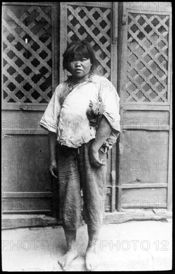 Mui tsai' child slave. Portrait of a barefooted child slave, employed as a domestic servant under the customary Chinese 'mui tsai' system. Possibly Hong Kong, (People's Republic of China), circa 1930. China, People's Republic of, Eastern Asia, Asia.