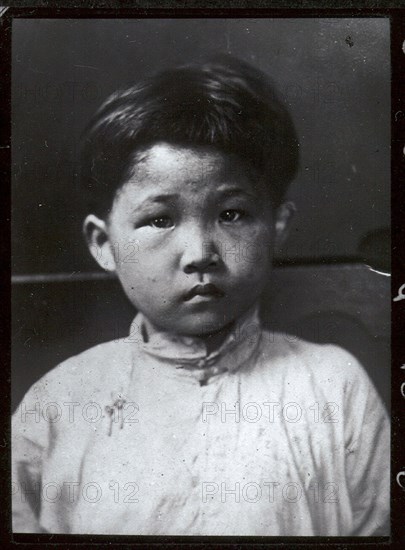 Child freed from 'mui tsai'. Portrait of a child slave, freed from domestic servitude under the customary Chinese 'mui tsai' system. Hong Kong, (People's Republic of China), circa 1930. Hong Kong, Hong Kong, China, People's Republic of, Eastern Asia, Asia.