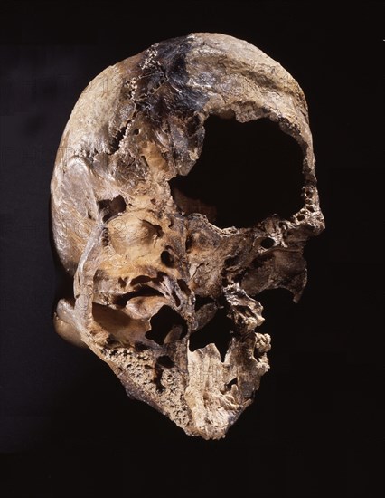 Neanderthal skull