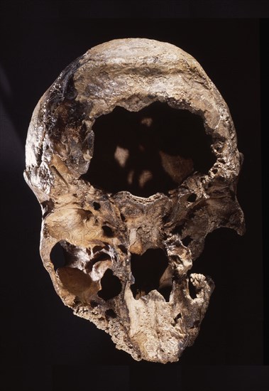 Neanderthal skull