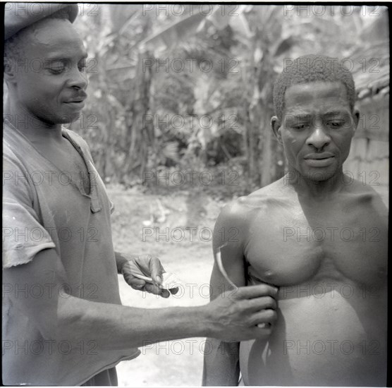 Passing Bamenda man treating Evai (cutting and rubbing in medicine)