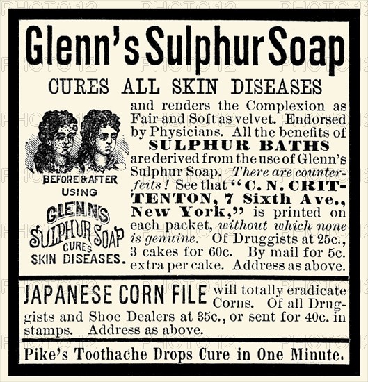 Glenn's Sulphur Soap 1890