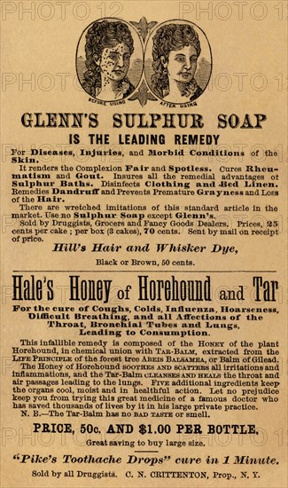 Glenn's Sulphur Soap is the Leading remedy 1890