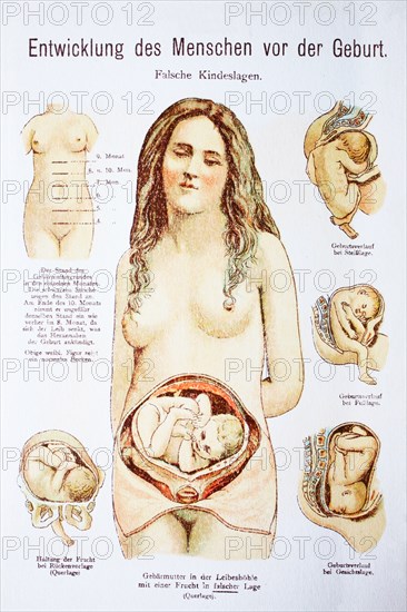 Development Of The Child Before The Birth In The Woman. Entwicklung Des Menschen Vor Der Geburt In Der Frau