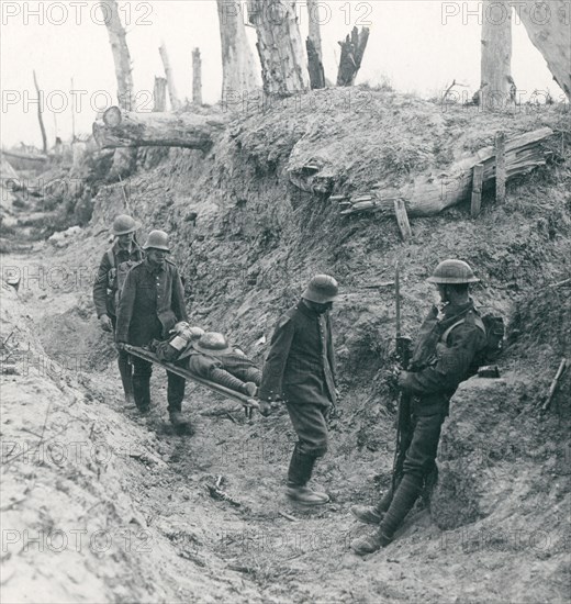 Stereoview WW1