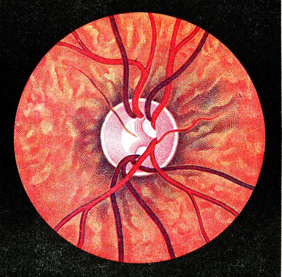 Bottom ( fundus ) of a normal eye, right eye 1902 ( published 1930 )