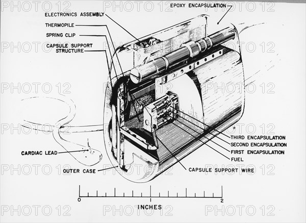 Nuclear-Powered Cardiac Pacemaker