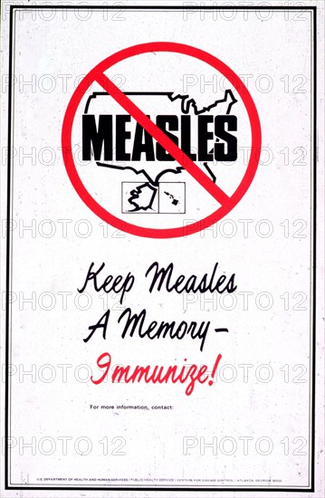 Measles Poster - Keep measles a memory-- immunize!