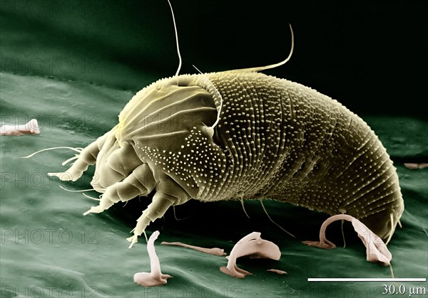 Electron scan micrography of Aceria anthocoptes or the (russet mite, rust mite, thistle mite or the Canada thistle mite)