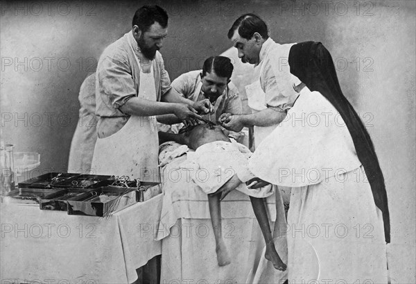 Binding arteries of Hindoo twins after operation ca. 1902