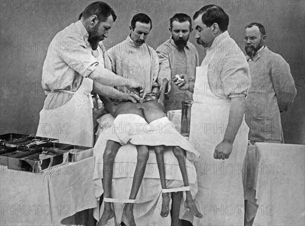 Dr. Doyen separating Hindoo twins ca. 1902