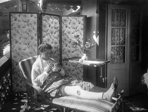 italy, valle d'aosta,  sanatorium, woman with plaster cast leg, 1910-20