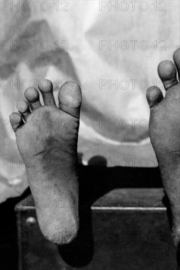 afrique, congo belge, la taille d'un pied pygmée est de 17,4 cm, 1927 1930
