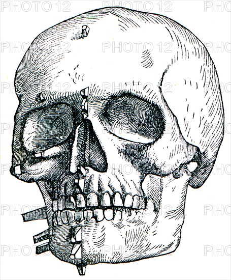 Skull from a woman.