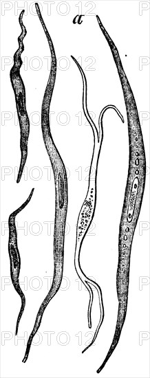 Smooth muscle cells.