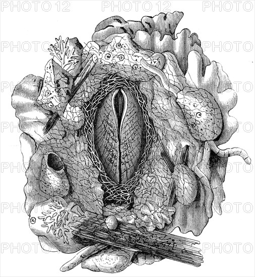 Rock Mussel Nest