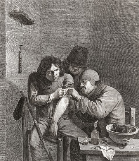 A surgeon operates on the arm of a patient in the 17th century.