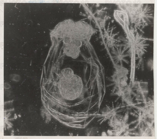 Asplanchna priodonta