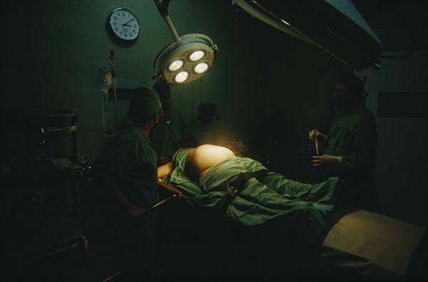 CUBA, Havana, Woman in labour lying on an operating table at the maternity hospital with lamps above her belly