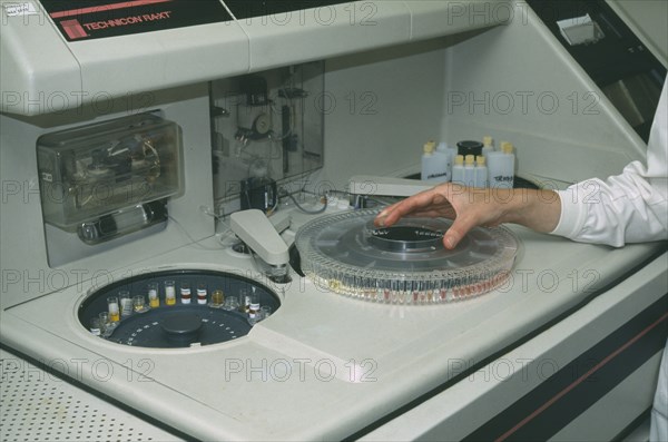 HEALTH, Blood, Serum Analyser with nurses hand on dial