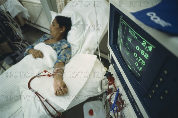 HEALTH, Kidney Dialysis, Woman lying in a bed with tubes running from her arm and monitor in the foreground