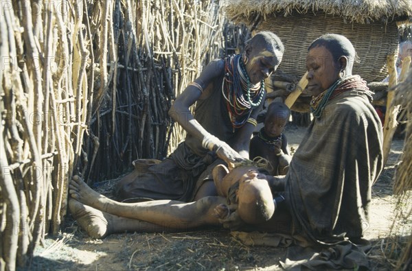 UGANDA, Karamoja, Female witch doctor or Amuron using sysal to suck out evil from child affected by the evil eye.  Karamojong women paint their faces with clay to prevent disease.