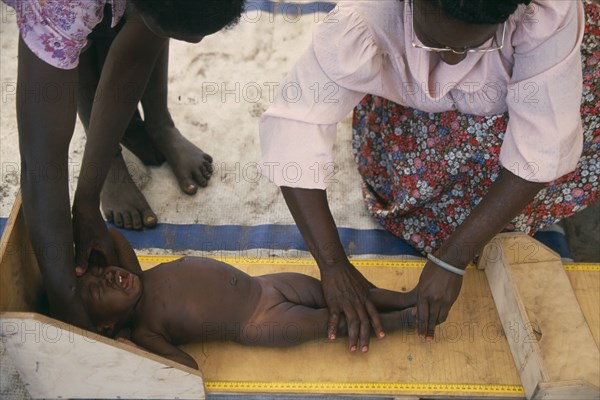 ZAMBIA, Mayukwayukwa Camp, Baby girl being measured in day feeding centre for malnourished children in camp for Angolan refugees.