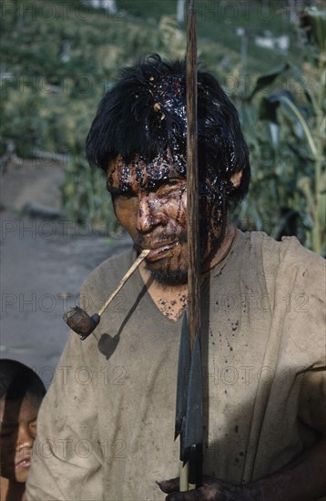 COLOMBIA, Sierra de Perija, Yuko - Motilon ., "Victim after a ritual bow fight in which aim is to hit the opponent’s head. Blood, now dried, has streamed from wound. Clutches his hard  “macana” wood bow and quiver of arrows, smoking a clay pipe"
