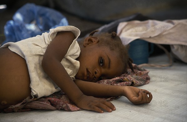 ZAMBIA, Mayukwayukwa Camp, Child lying on mattress in day feeding centre for malnourished children in camp for Angolan refugees.
