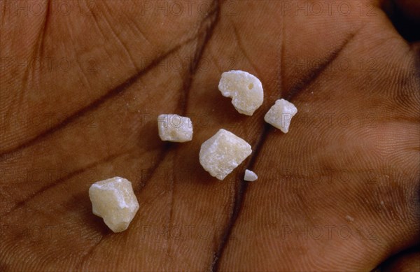 COLOMBIA, Vaupes, "Crystalized cocaine base displayed on palm of hand in illegal lab. in Vaupes Intendencia, N W Amazon "