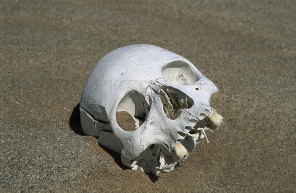 Namibia, Namib Naukluft desert., Skeleton head unearthed as the dunes have shifted. This corpse was left over from the graves of a diamond mine in Namib Naukluft desert. Probably from the turn of the 19th to 20th century. Access is restricted due to Diamond mining activity by De Beers. 
Photo : Adrian Arbib